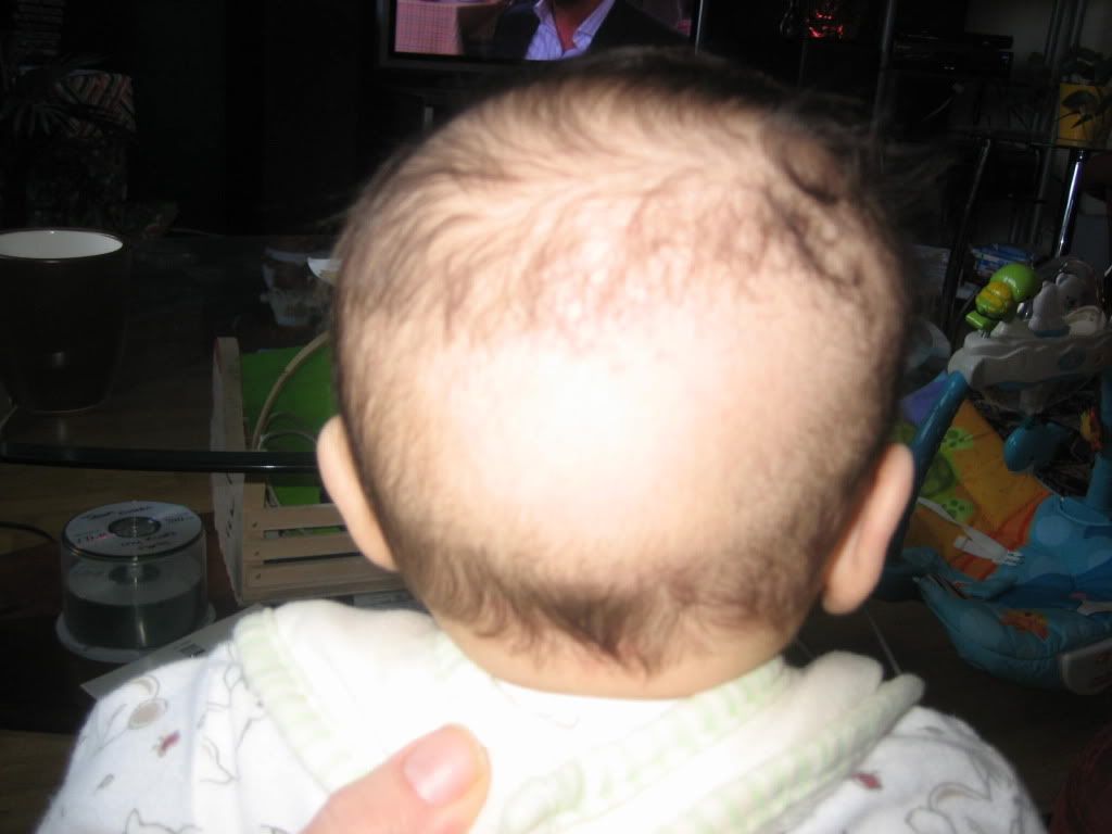Lets see those baby bald spots!! BabyCenter